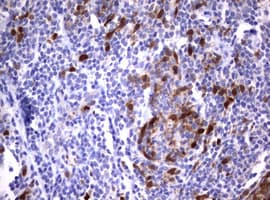 TS / Thymidylate Synthase Antibody (clone OTI1A6)