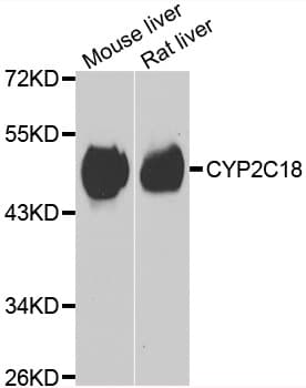Polyclonal Rabbit anti-Human CYP2C18 / CYP2C Antibody (IHC, WB)