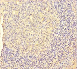 CSF1 / MCSF Antibody (aa33-554)