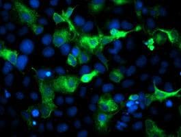 ERBB2 / HER2 Antibody (aa676-1255, clone OTI5A3, Carrier-free)
