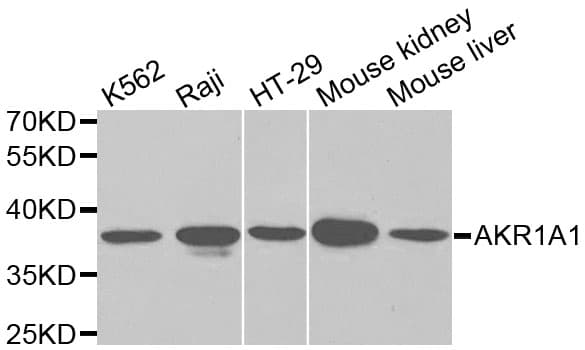 Polyclonal Rabbit anti-Human AKR1A1 Antibody (IHC, IF, WB)