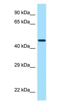 CRHR2 / CRF2 Receptor Antibody (aa68-117)