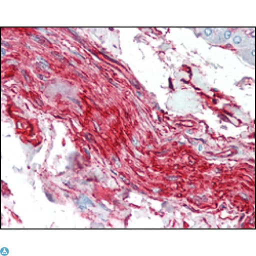 S100A10 Antibody