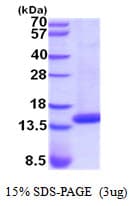 Human CST5 Protein (Recombinant His)