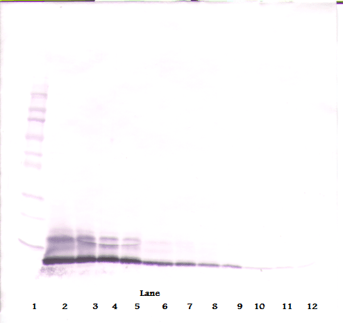 Polyclonal Rabbit anti-Human CCL14 Antibody (WB)
