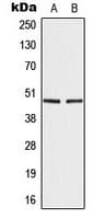 Polyclonal Rabbit anti-Human IRF4 Antibody (Internal, IHC, IF, WB)