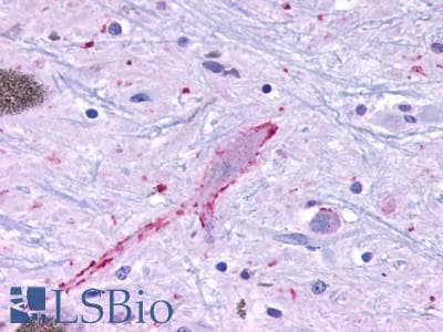 PathPlus™ MRGPRF Antibody (C-Terminus)