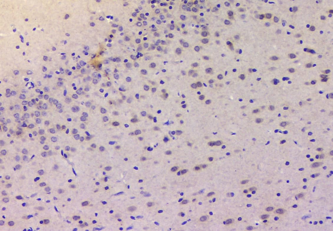 CDKN1B / p27 Kip1 Antibody (aa10-198)