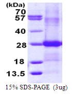 Human EFNB2 / Ephrin B2 Protein (Recombinant His)