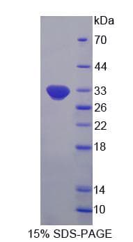 Human OASL Protein (Recombinant His-S)