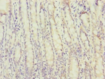 MTERF2 / MTERFD3 Antibody