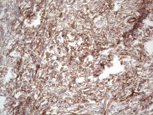 Peripherin Antibody (clone UMAB202, Carrier-free)