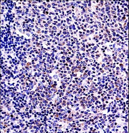 BAFF / TNFSF13B Antibody (aa16-44)