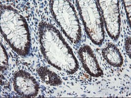 TPRKB Antibody (clone OTI3H3)