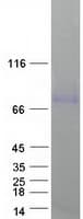 Human SMPD1 / Acid Sphingomyelinase Protein (Recombinant Myc-DDK (Flag))