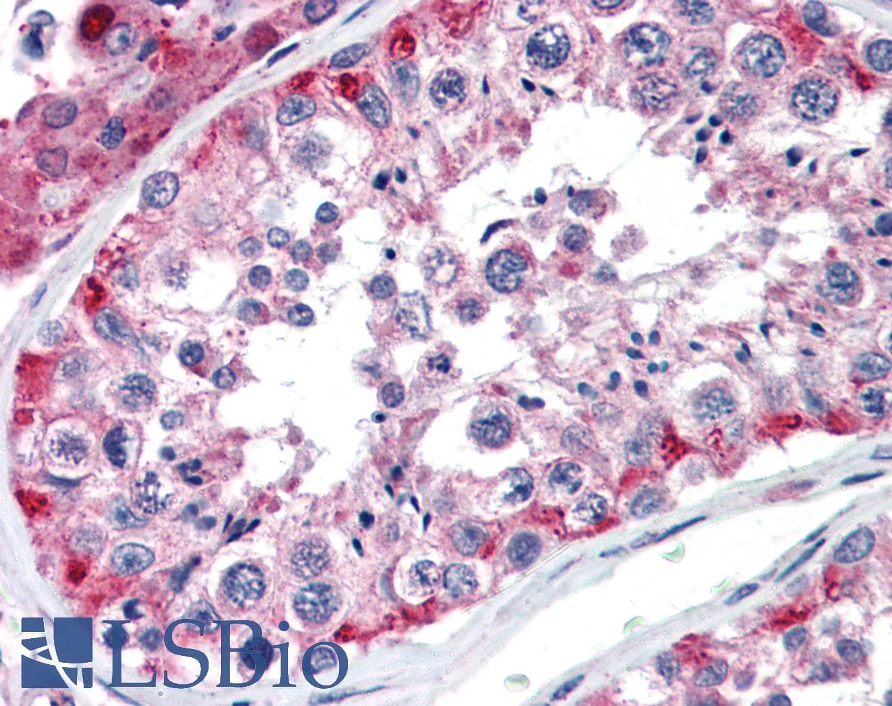 NAB1 Antibody (aa71-120)