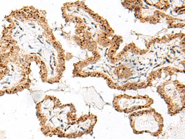 FAM84B Antibody