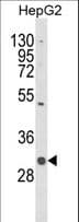 C1QTNF6 / CTRP6 Antibody (aa27-53)