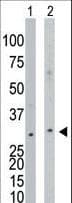 NAGK Antibody (aa31-61)