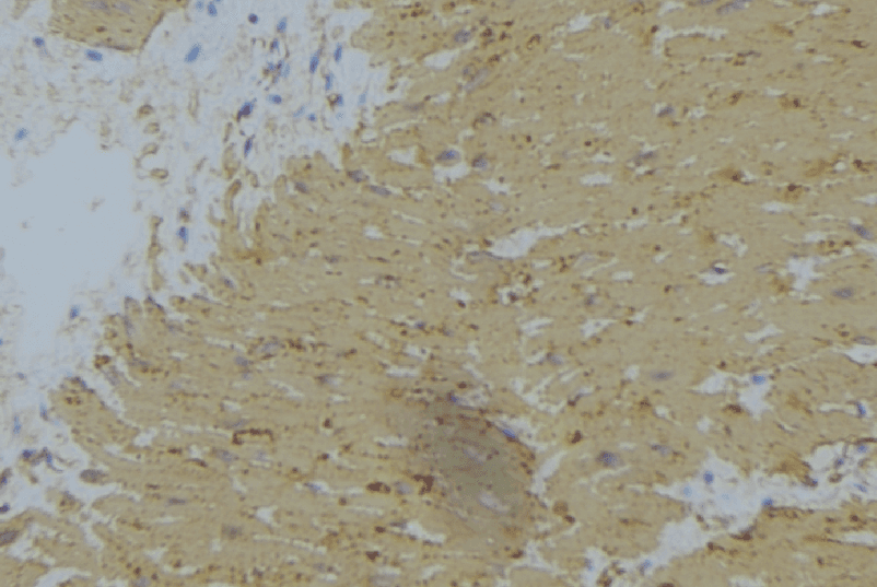 WNK1 Antibody
