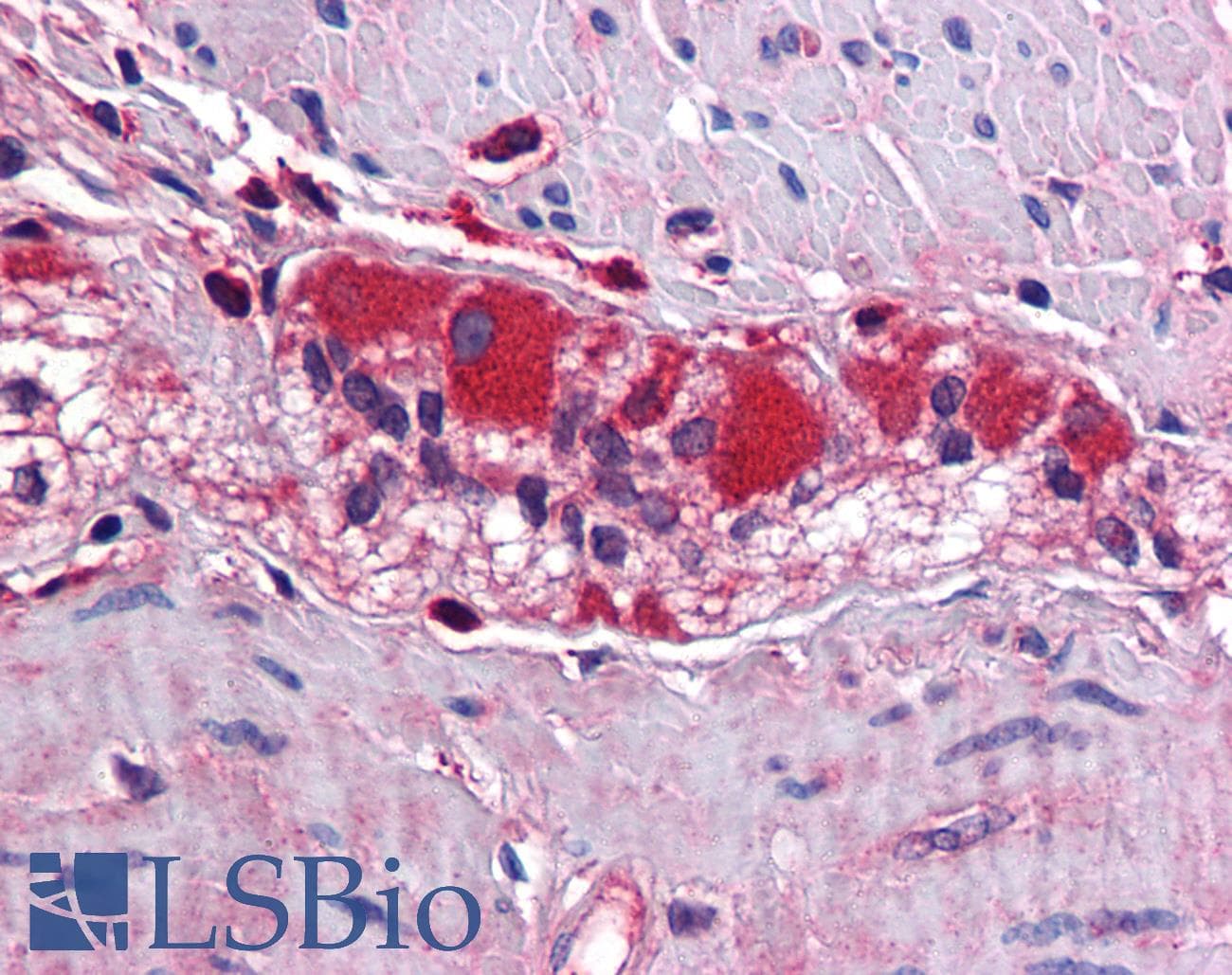 KCNJ8 / Kir6.1 Antibody (C-Terminus)