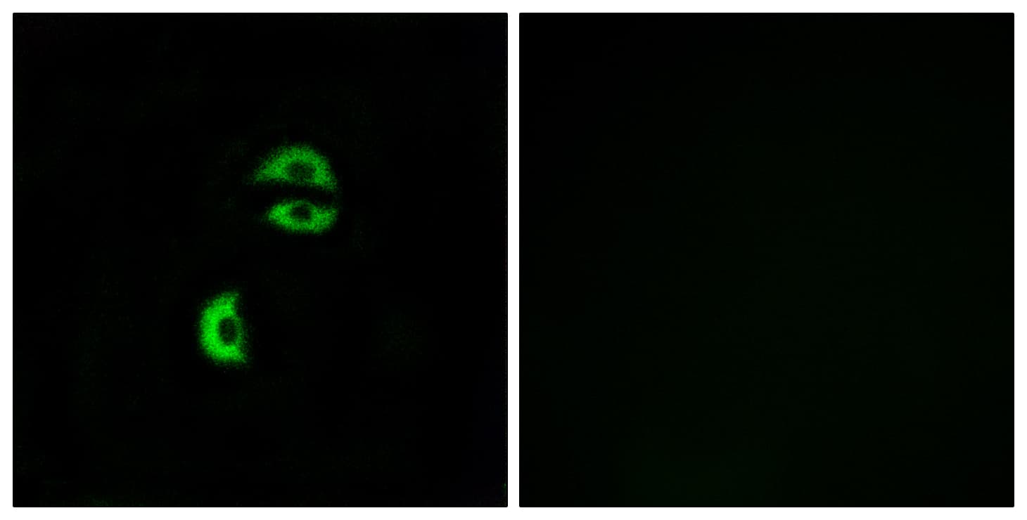 LDLRAD3 Antibody (aa37-86)