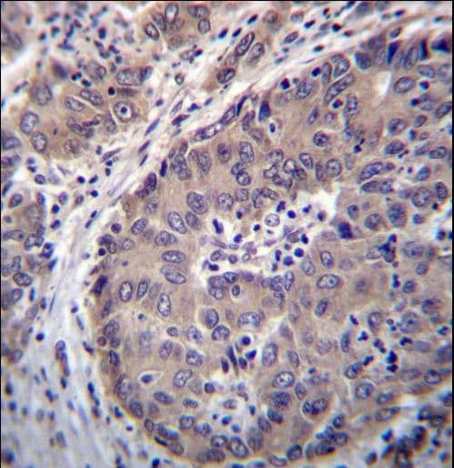PNLIPRP3 Antibody (aa63-92)