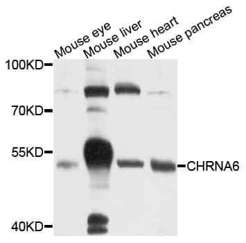 Polyclonal Rabbit anti-Human CHRNA6 Antibody (WB)