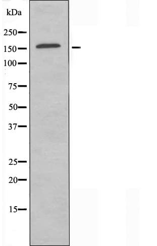 Polyclonal Rabbit anti-Human ABCC10 Antibody (IF, WB)