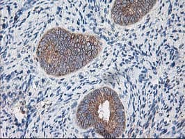 RPN1 / Ribophorin I Antibody (clone OTI3H3)
