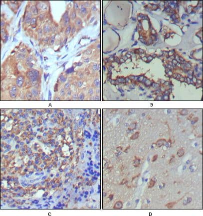 WNT5A Antibody (clone 6F2)