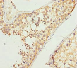 NCALD / Neurocalcin Delta Antibody