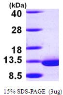 Human DYNLRB1 Protein (Recombinant His)