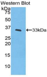 IL20RB Antibody (aa37-290)
