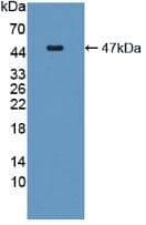 Human IL6 / Interleukin 6 Protein (Recombinant His-GST, N-terminus)