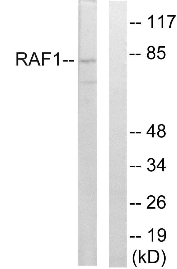 RAF1 / RAF Antibody (p289)