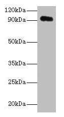 APP / Beta Amyloid Precursor Antibody