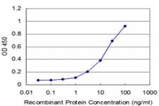 IHC-plus™ PBX3 Antibody (clone 1A11)