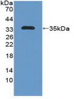 MAP1B Antibody (Biotin)