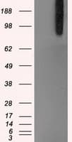 BRAF / B-Raf Antibody (clone OTI4C11)