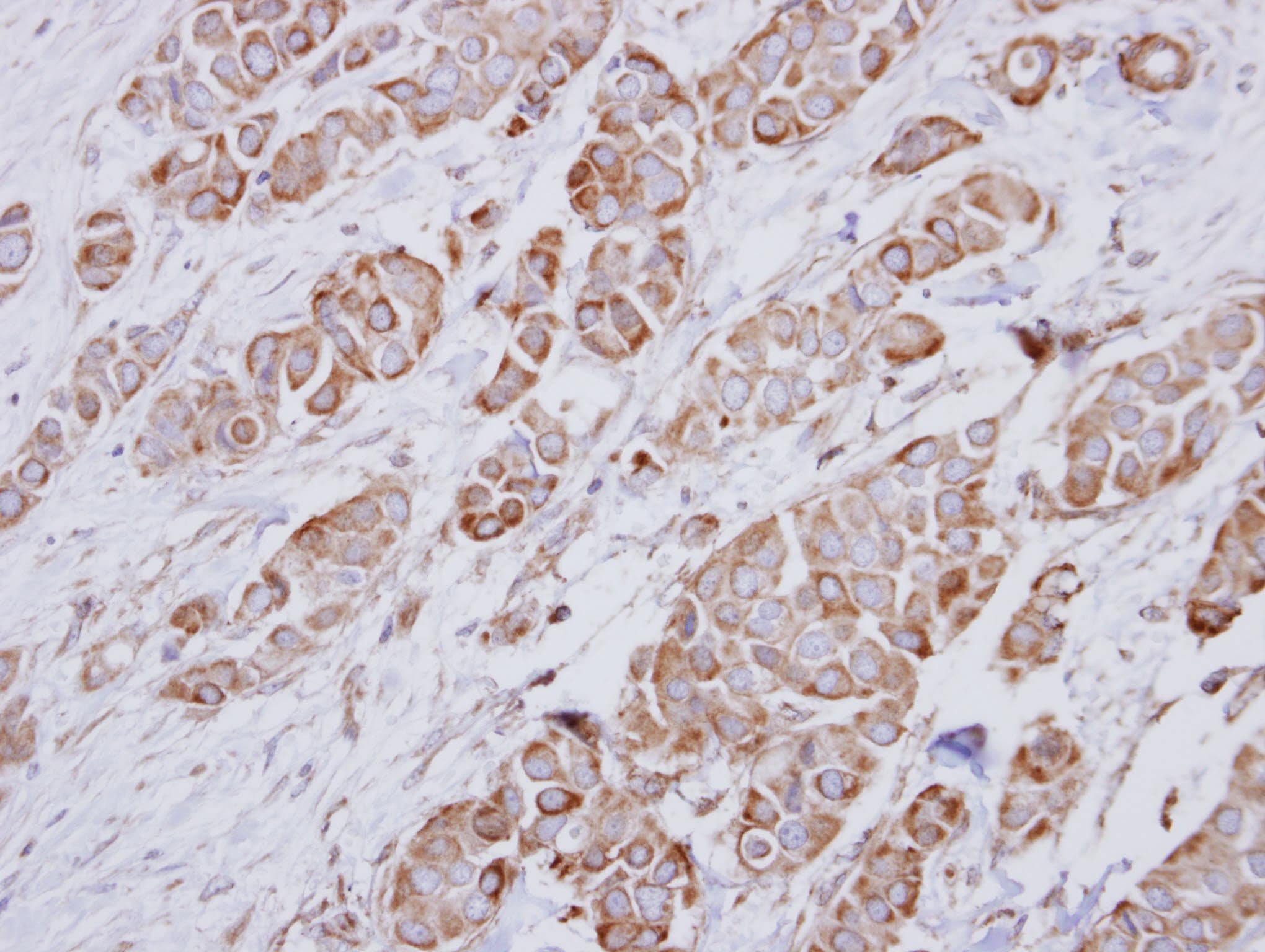 Polyclonal Rabbit anti-Human NDUFA10 Antibody (aa115-355, IHC, WB)