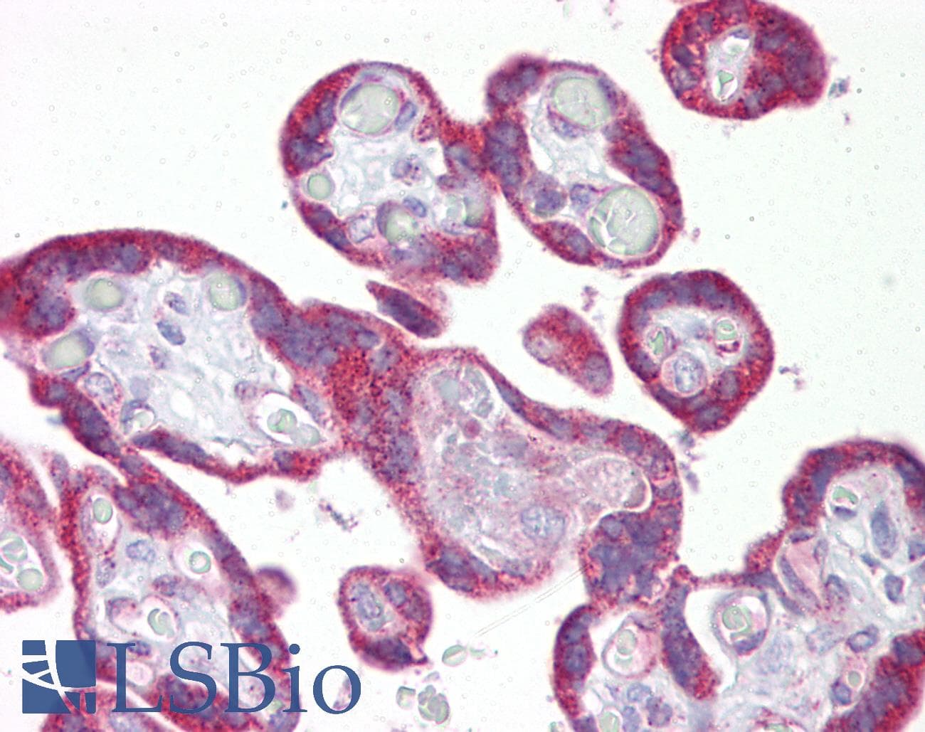 KRT23 / Keratin 23 Antibody (C-Terminus)