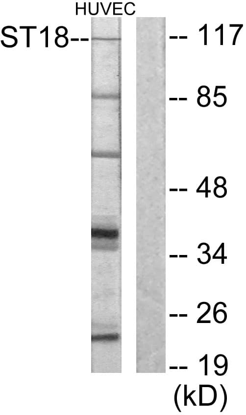 IHC-plus™ MYT1 Antibody (aa41-90)