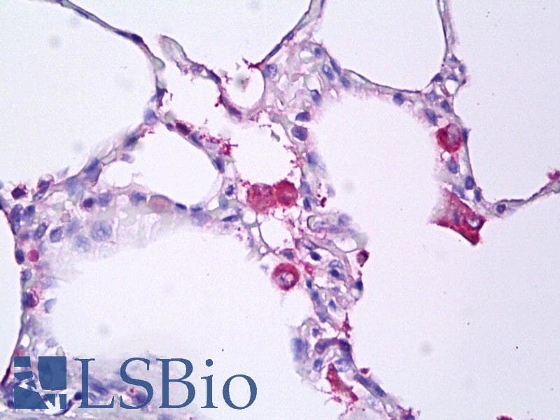 IHC-plus™ Monoclonal Mouse anti-Human TNF Alpha Antibody (clone 2C8, IHC)