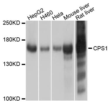 CPS1 Antibody
