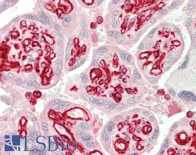 IHC-plus™ ATP6E / ATP6V1E1 Antibody (clone 4E11)