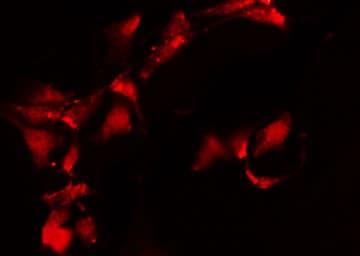 Polyclonal Rabbit anti-Human IKBKG / NEMO / IKK Gamma Antibody (IHC, IF, WB)