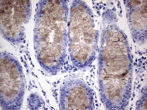 RSPO1 / RSPO Antibody (aa21-263, clone OTI1C3)