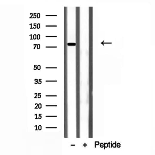 COIL / Coilin Antibody