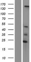 UBN2 Protein (Over-Expression Lysate Myc-DDK (Flag))